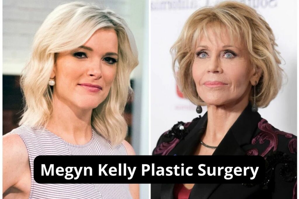 Megyn Kelly Plastic Surgery