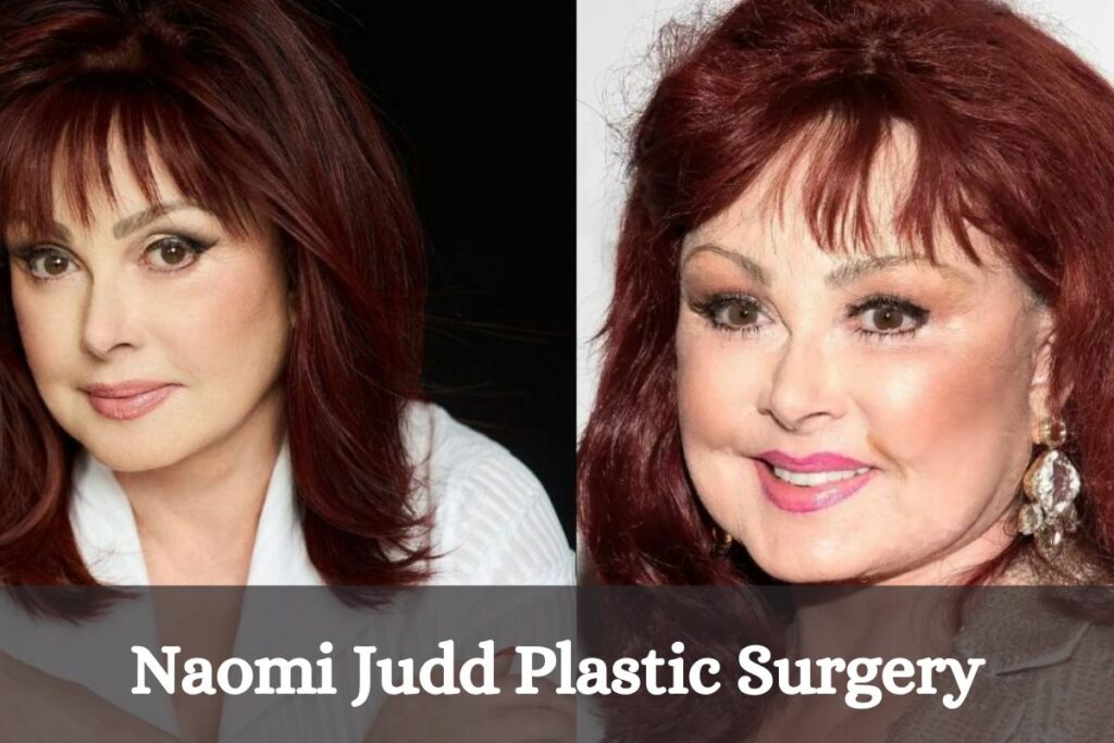 Naomi Judd Plastic Surgery