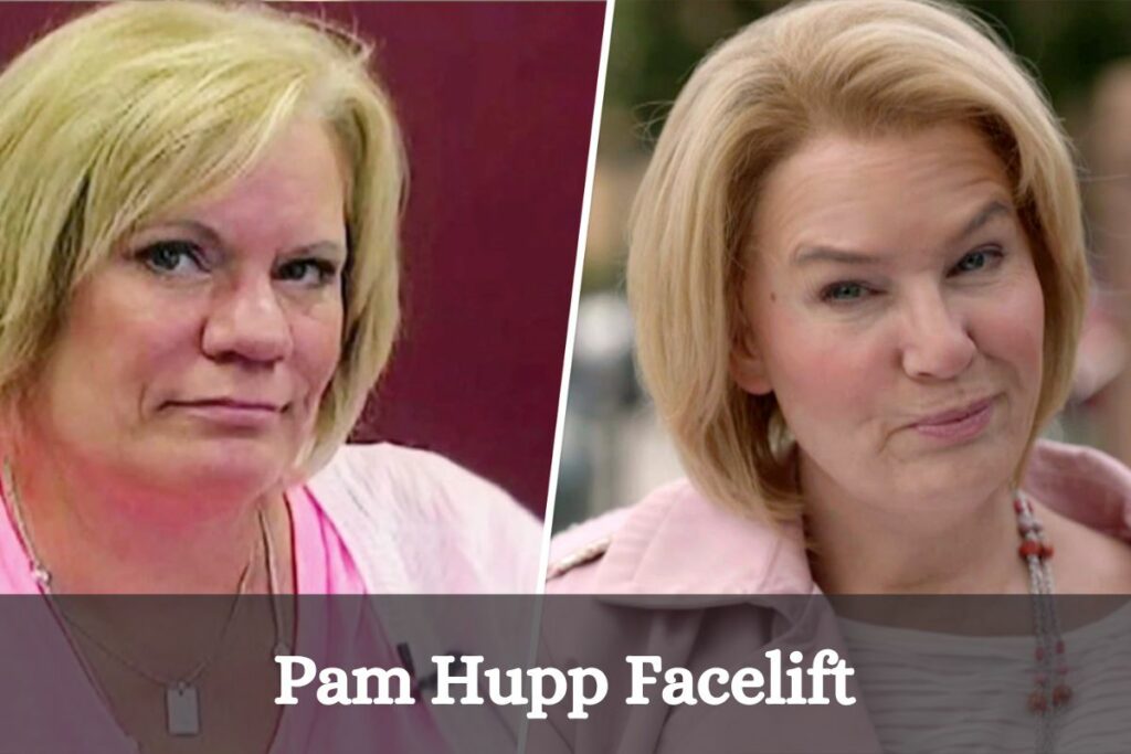 Pam Hupp Facelift