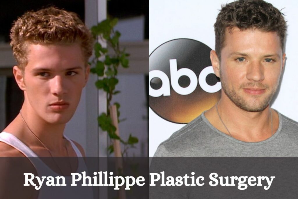 Ryan Phillippe Plastic Surgery