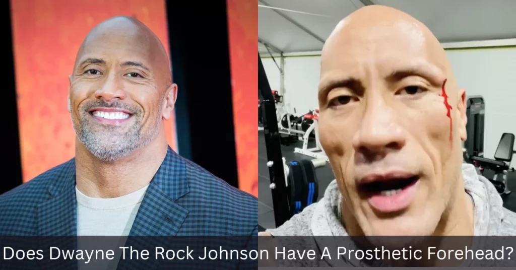 Does Dwayne The Rock Johnson Have A Prosthetic Forehead