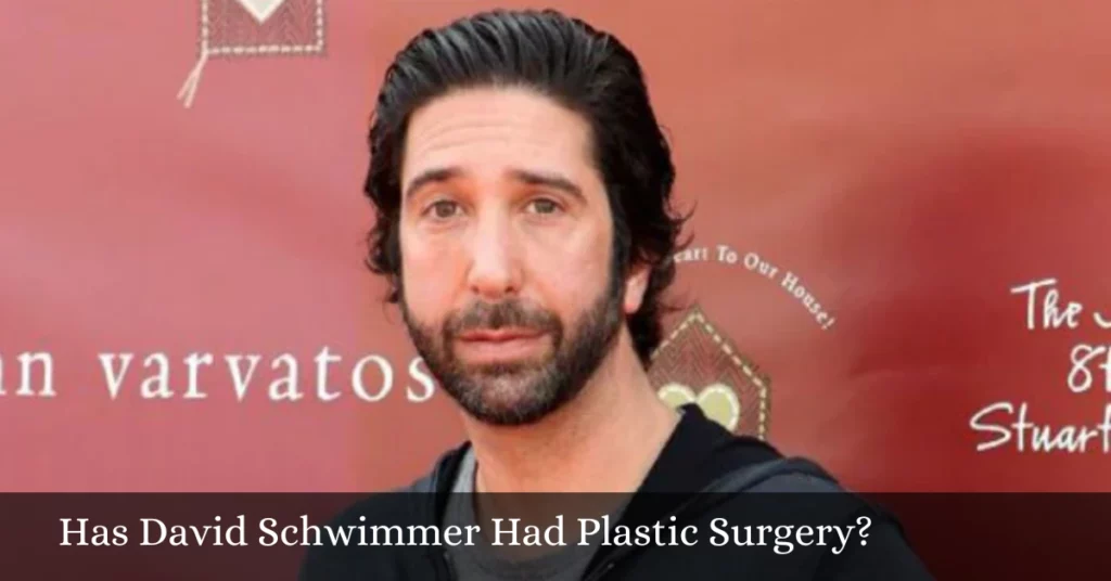 Has David Schwimmer Had Plastic Surgery?