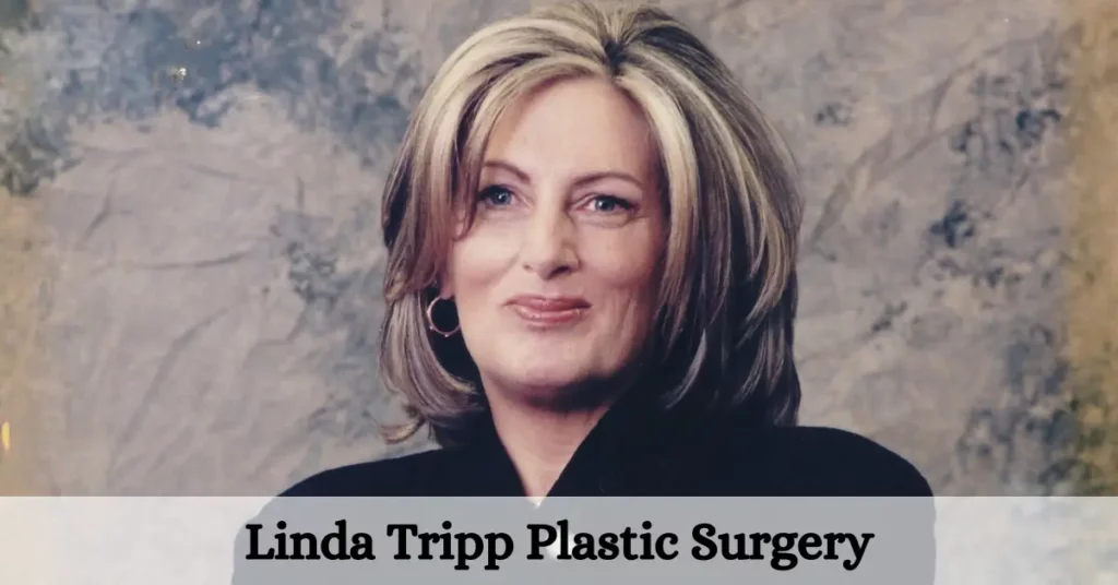Linda Tripp Plastic Surgery