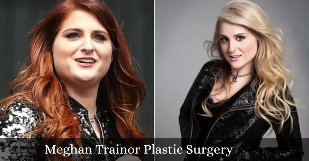 Meghan Trainor Plastic Surgery