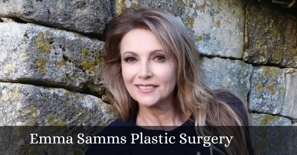 Emma Samms Plastic Surgery