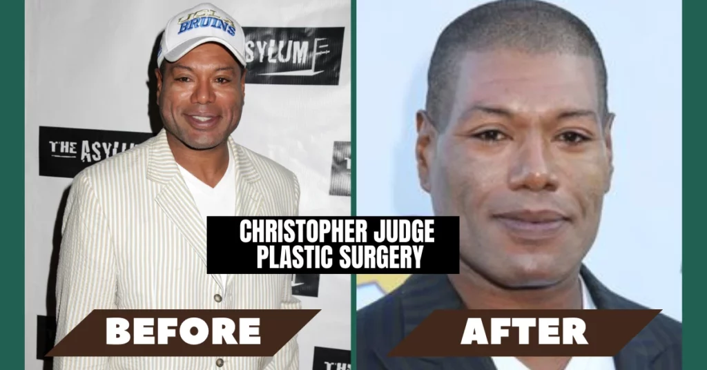 Christopher Judge Plastic Surgery