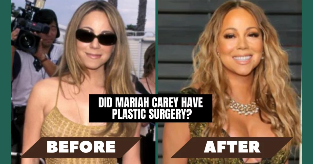 Did Mariah Carey Have Plastic Surgery?