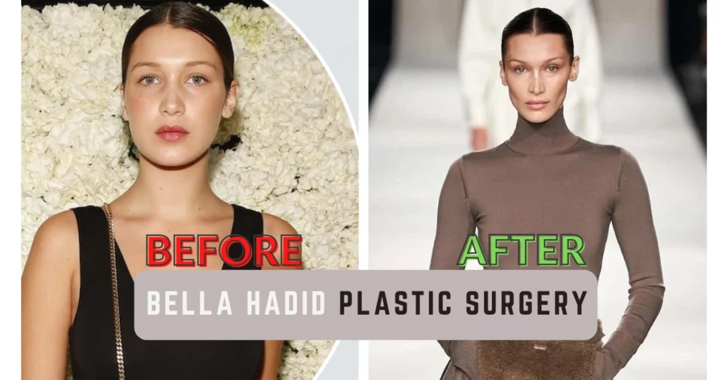 Bella Hadid Plastic Surgery