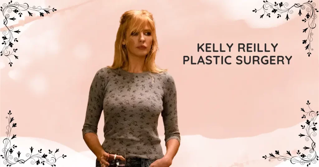 Kelly Reilly Plastic Surgery