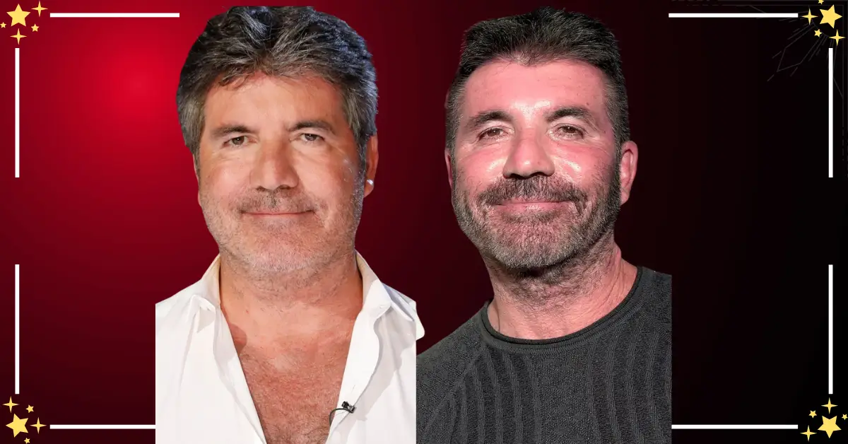 Simon Cowell Before And After Plastic Surgery