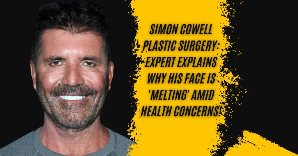 Simon Cowell Plastic Surgery Expert Explains Why His Face Is 'Melting' Amid Health Concerns!