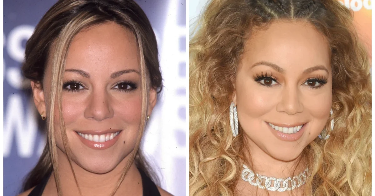 Did Mariah Carey Have Plastic Surgery?