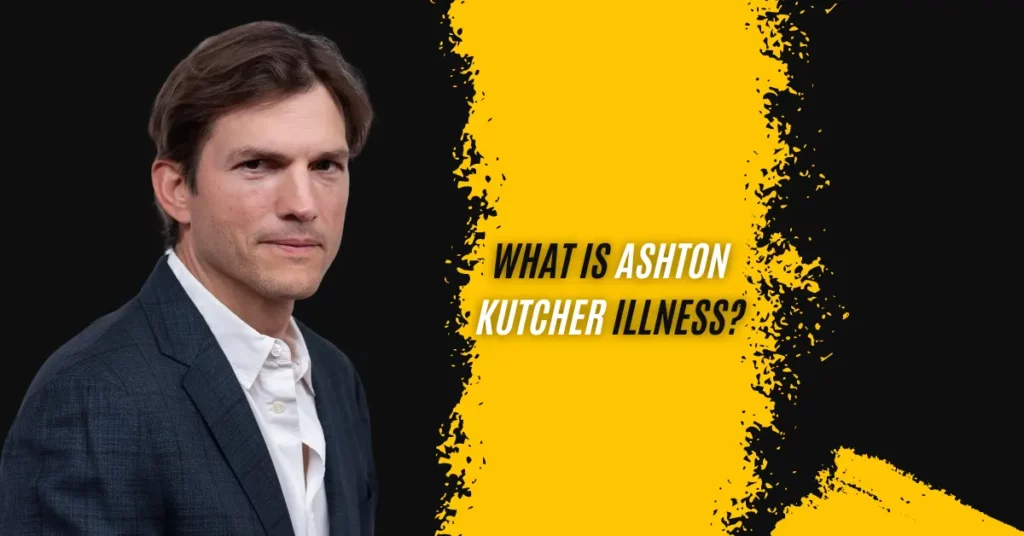 What Is Ashton Kutcher Illness
