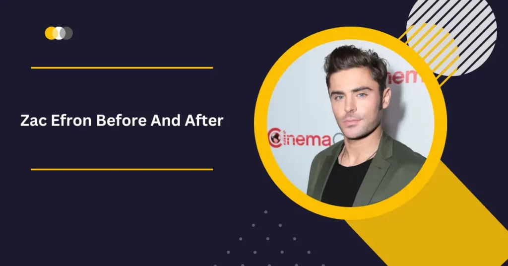 Zac Efron Before And After