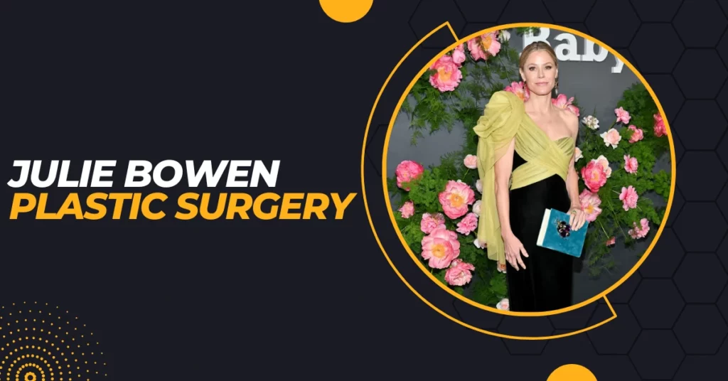 Julie Bowen Plastic Surgery