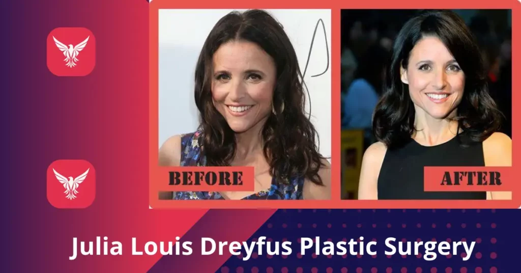 Julia Louis Dreyfus Plastic Surgery
