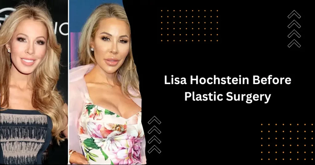 Lisa Hochstein Before Plastic Surgery