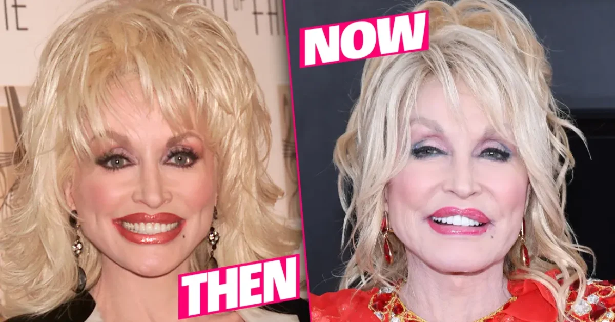 Has Dolly Parton Had Plastic Surgery? Does She Wear A Wig?