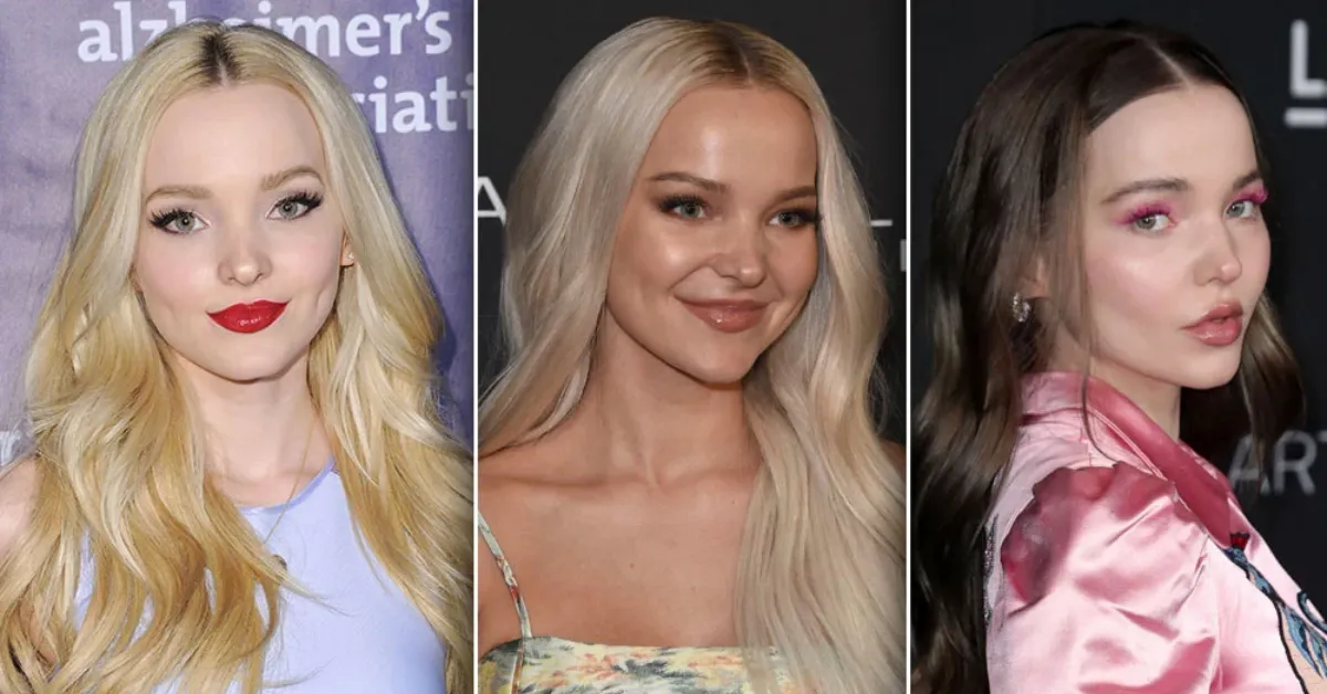 Did Dove Cameron Get Plastic Surgery? Before And After Look
