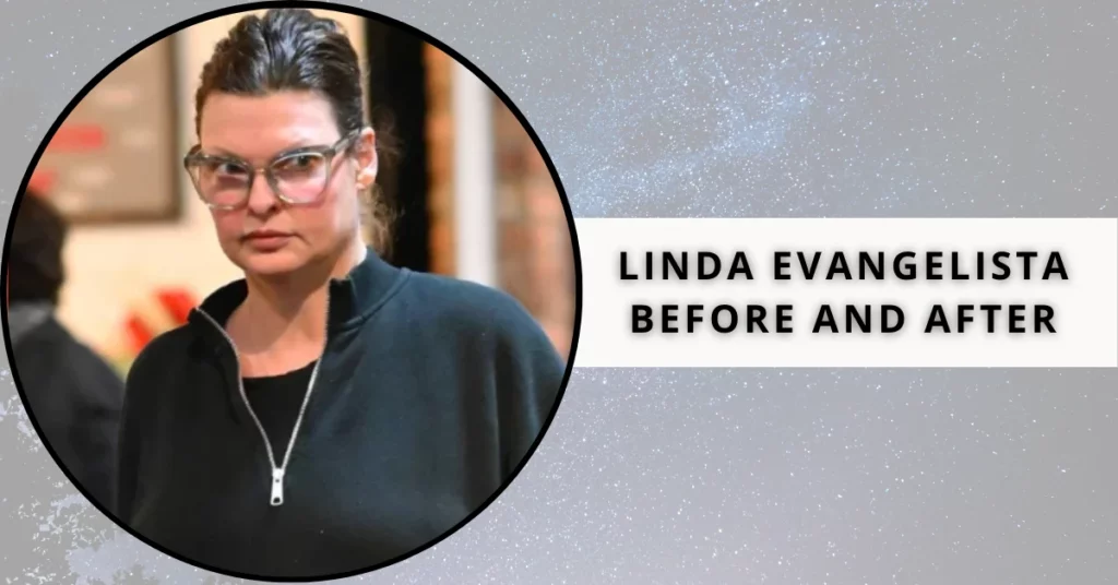 Linda Evangelista Before And After