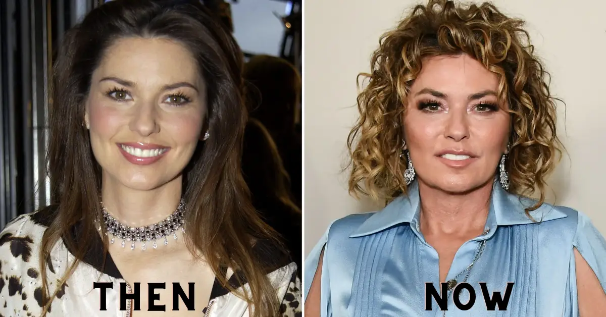 Did Shania Twain Get Plastic Surgery