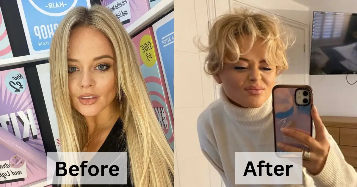 Emily Atack Transformation