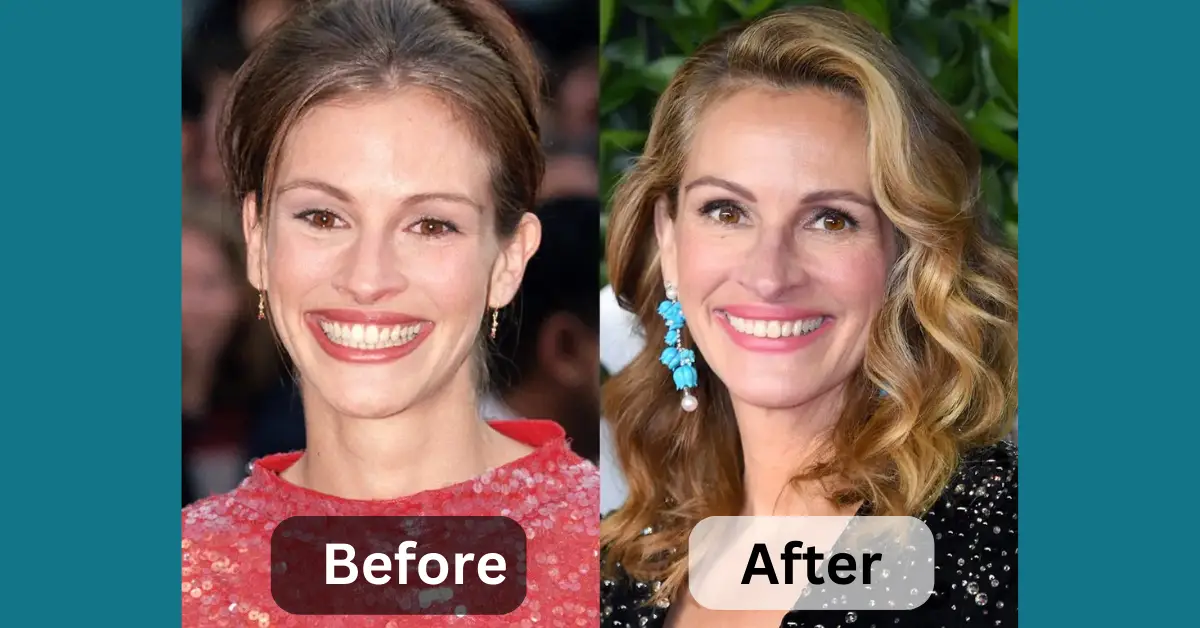 Julia Roberts Before And After
