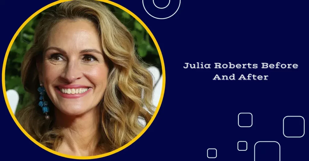 Julia Roberts Before And After