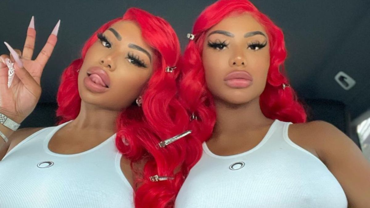 clermont twins before and after-